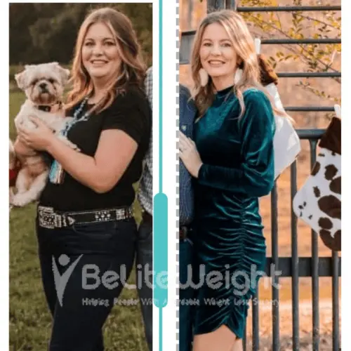 Kayla .M gastric sleeve update after 2 years*